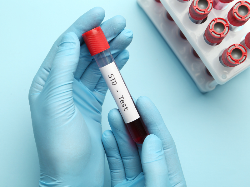 Quels tests pour dépister une IST ?