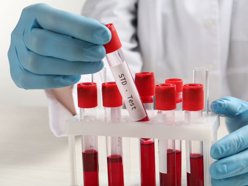 Quels tests pour dépister une IST ?