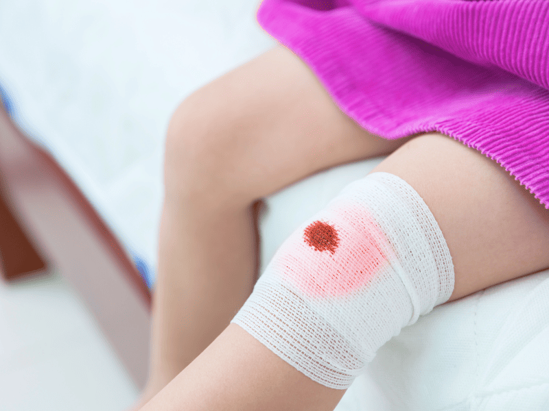 Genou blessé d'un enfant : accidents courants chez les enfants