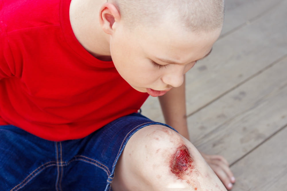 Enfant hémophile qui s'est blessé au genou et qui saigne beaucoup.