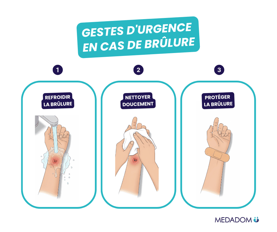 Illustrations gestes d'urgence en cas de brûlure