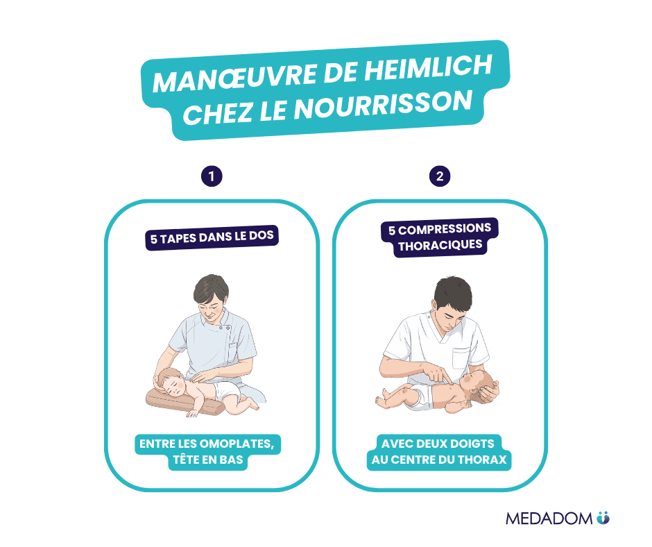 Illustrations article geste premier secours avec une manœuvre de Heimlich chez le nourrisson