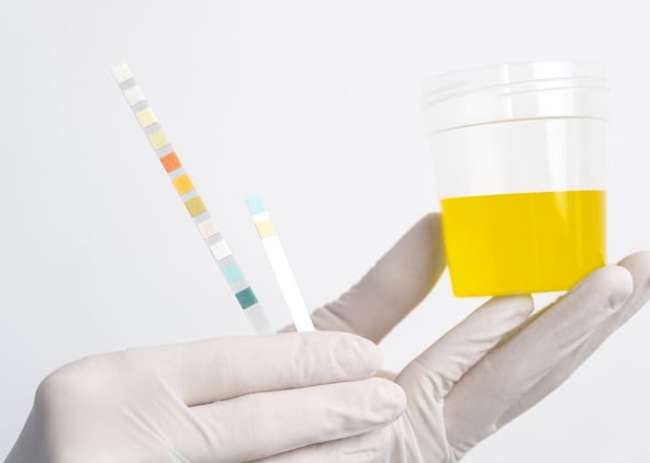 Pharmacien tenant le flacon d'urine d'une patiente avec les bandelettes de couleur pour détecter une infection urinaire en pharmacie.