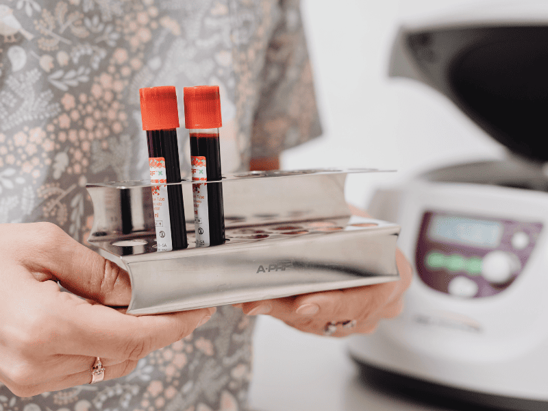 Analyse de polynucléaires éosinophiles élevés 