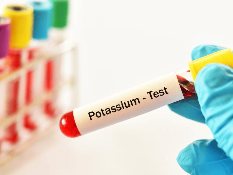 Test sanguin pour détecter un potassium élevé