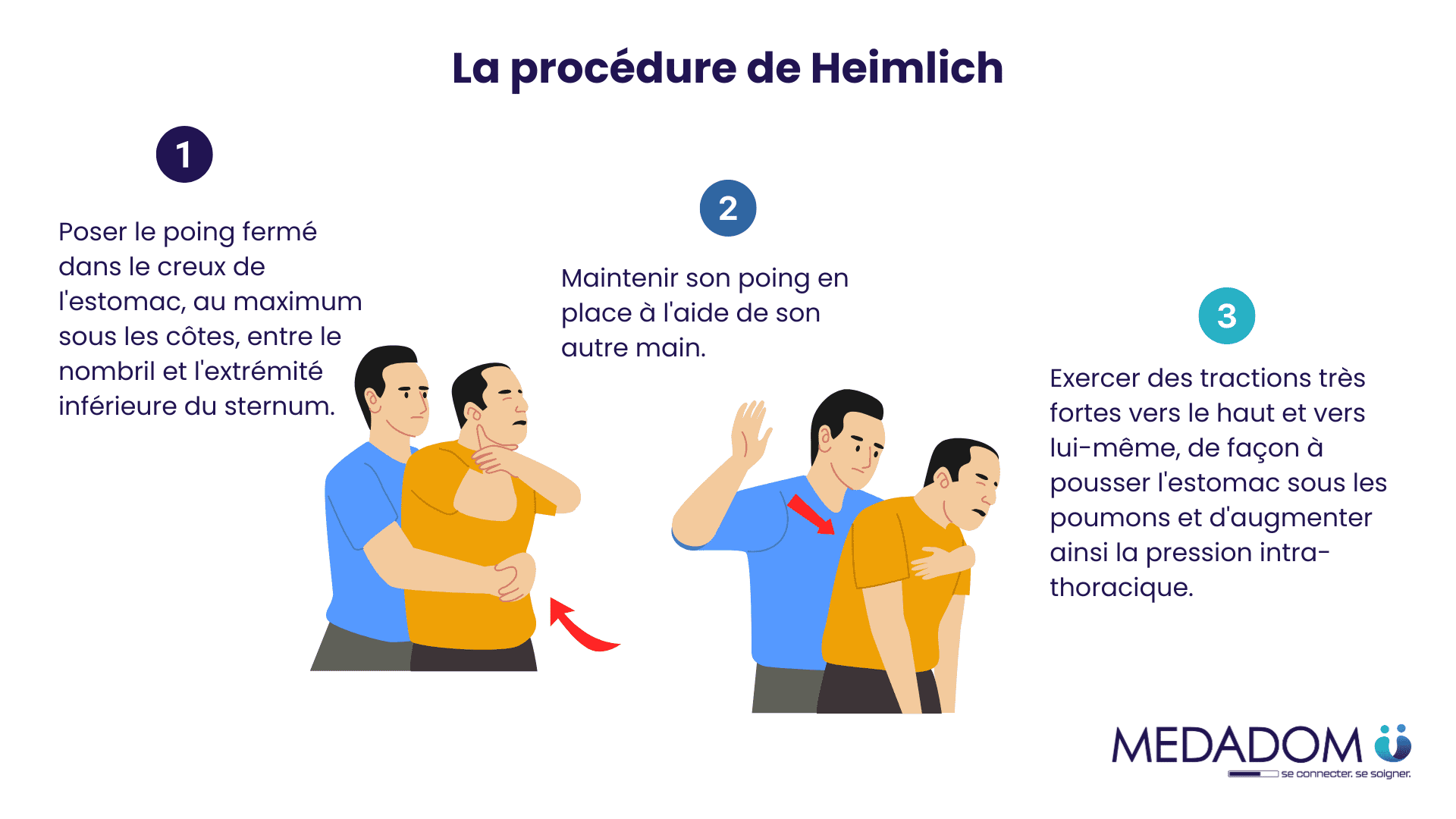 Schéma 3  procédure de Heimlich