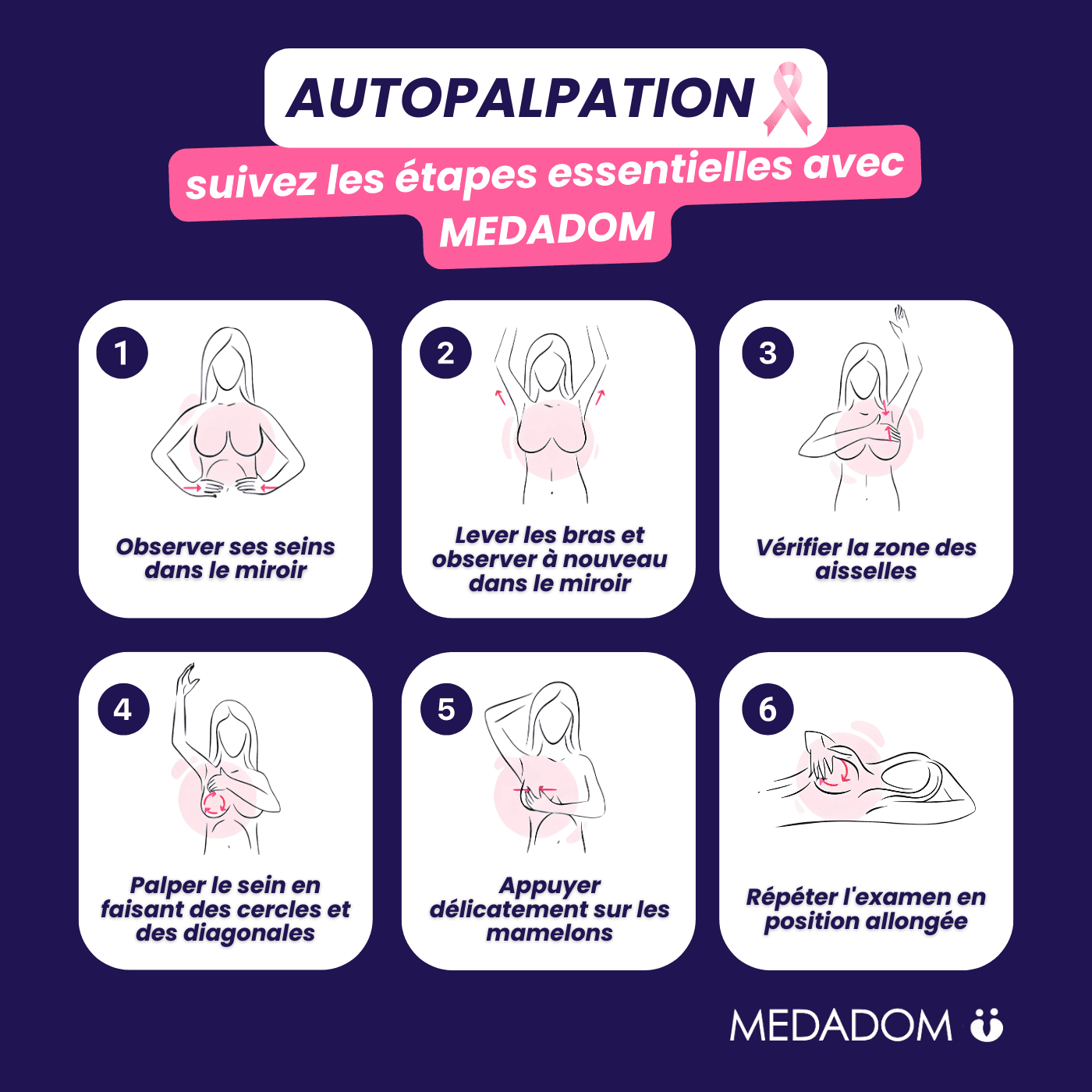 Les étapes de l'auto-palpation des seins pour détecter un cancer du sein avec MEDADOM