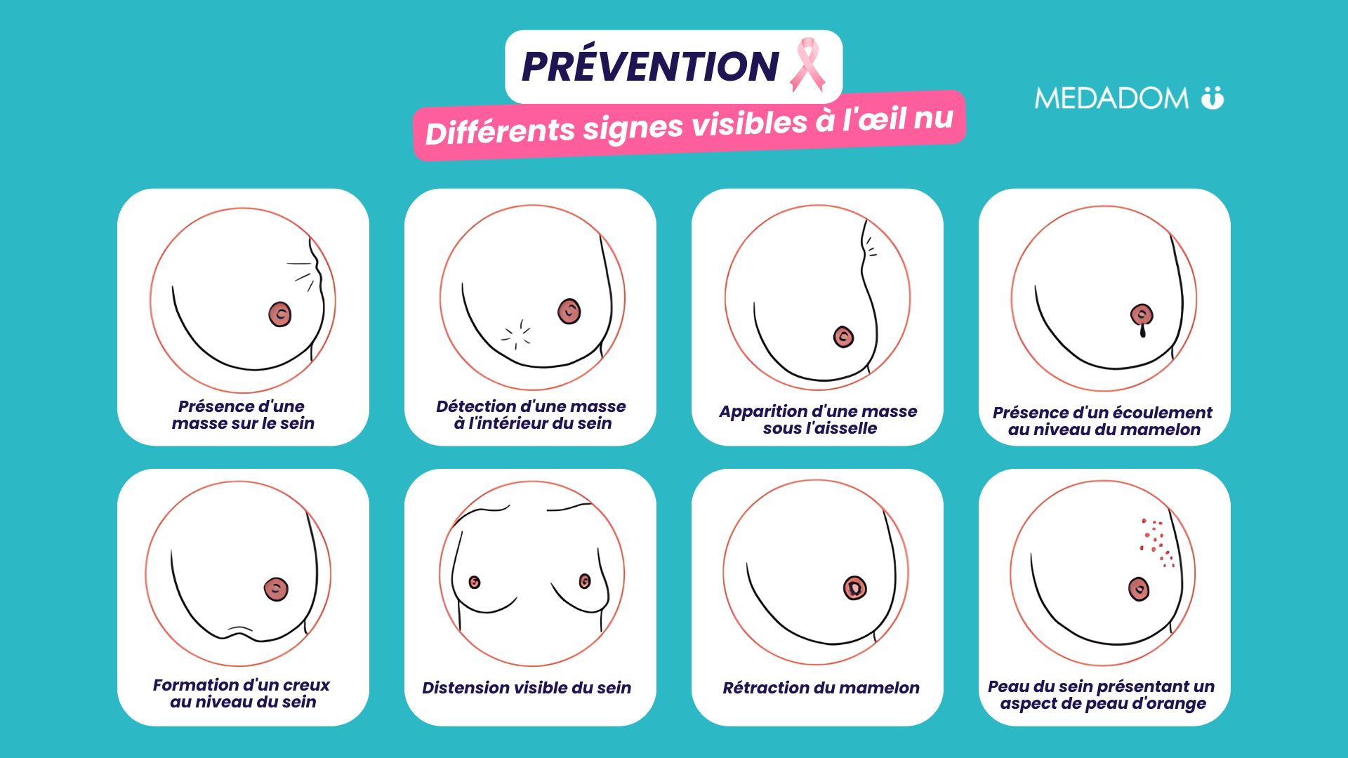 Octobre rose Différents signes visibles à l'œil nu pour détecter un cancer du sein