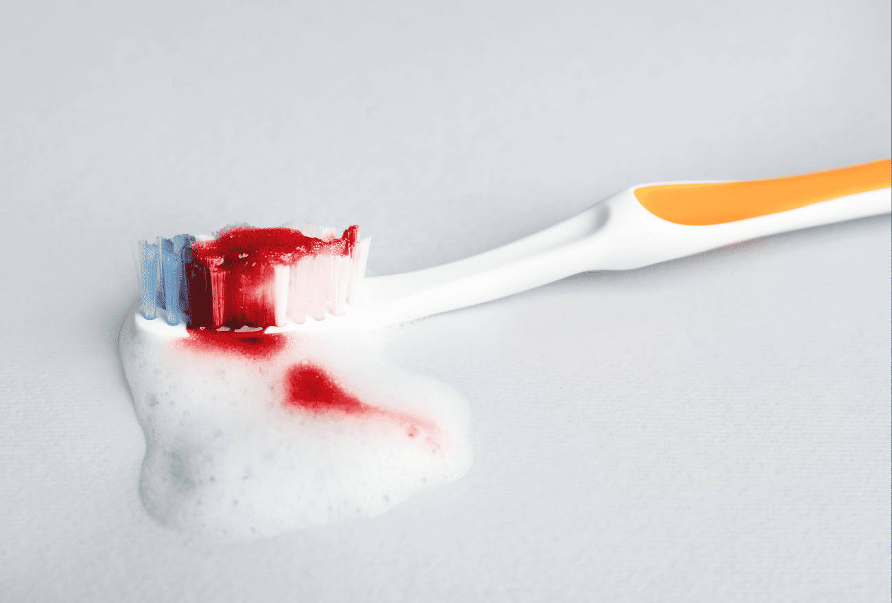 Brosse à dents avec du sang après un brossage de dents.