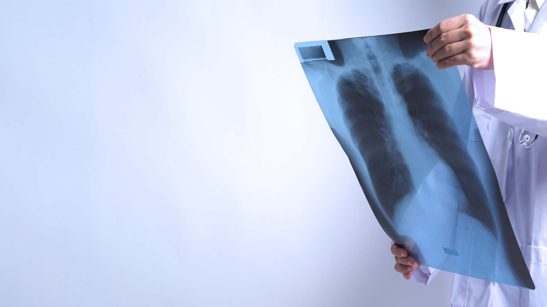 Tuberculose  infection des poumons