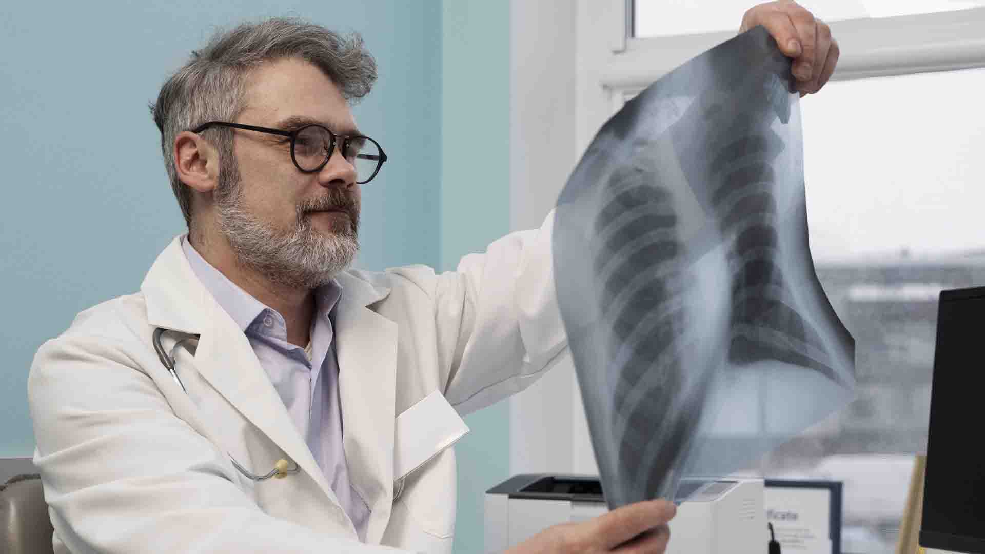 Médecin analysant une radiologie des poumons pour vérifier s'il y a un BPCO.