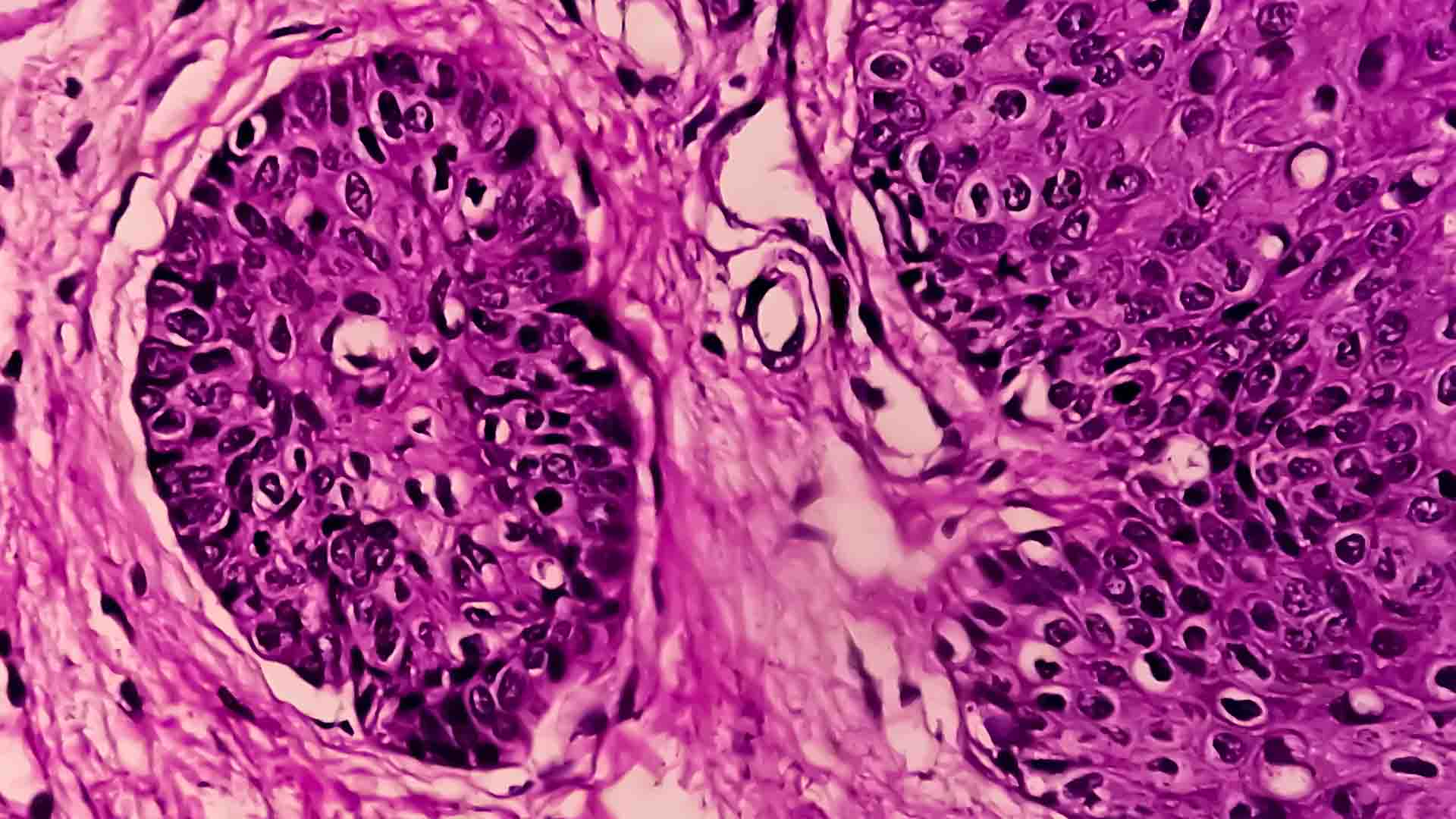 Combien de temps met le papillomavirus à être détecté