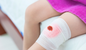 Panorama des accidents courants chez les enfants