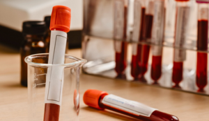 Créatinine élevée