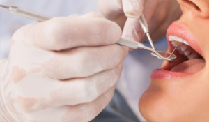 Dispositif M’T Dents : tout savoir sur son fonctionnement
