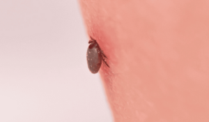 Morsure de tique : les réflexes pour éviter la maladie de Lyme