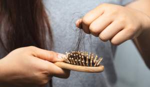 Perte de cheveux