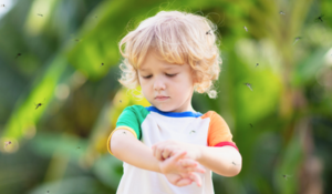 Piqûres d’insectes chez les enfants : quand s’inquiéter des piqûres