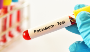 Potassium élevé dans le sang (hyperkaliémie)