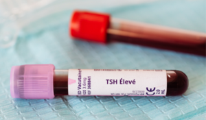 Taux de TSH élevé, zoom sur les causes, symptômes et traitements possibles