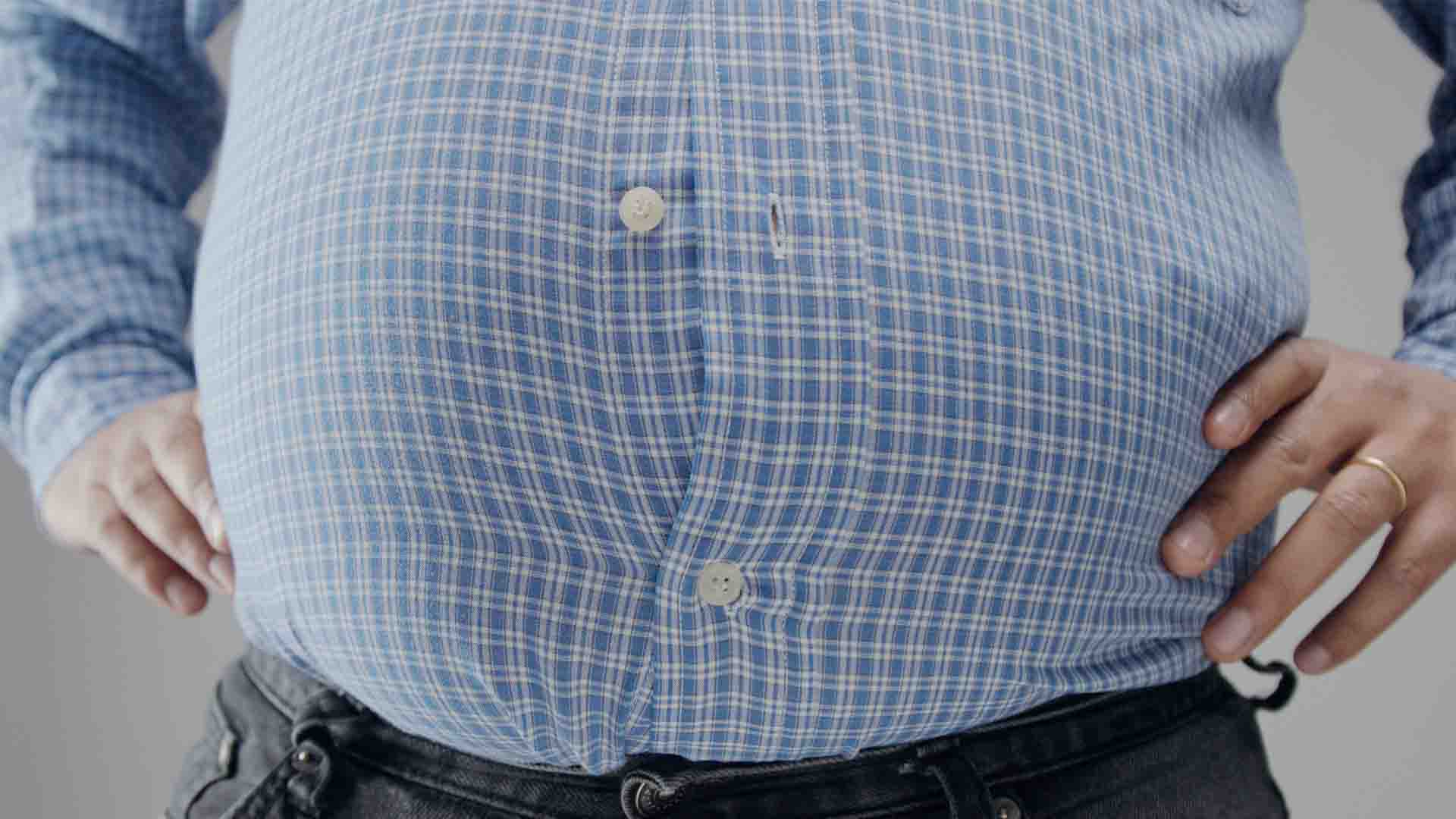 La sleeve consiste en la résection d'une grande partie de l'estomac