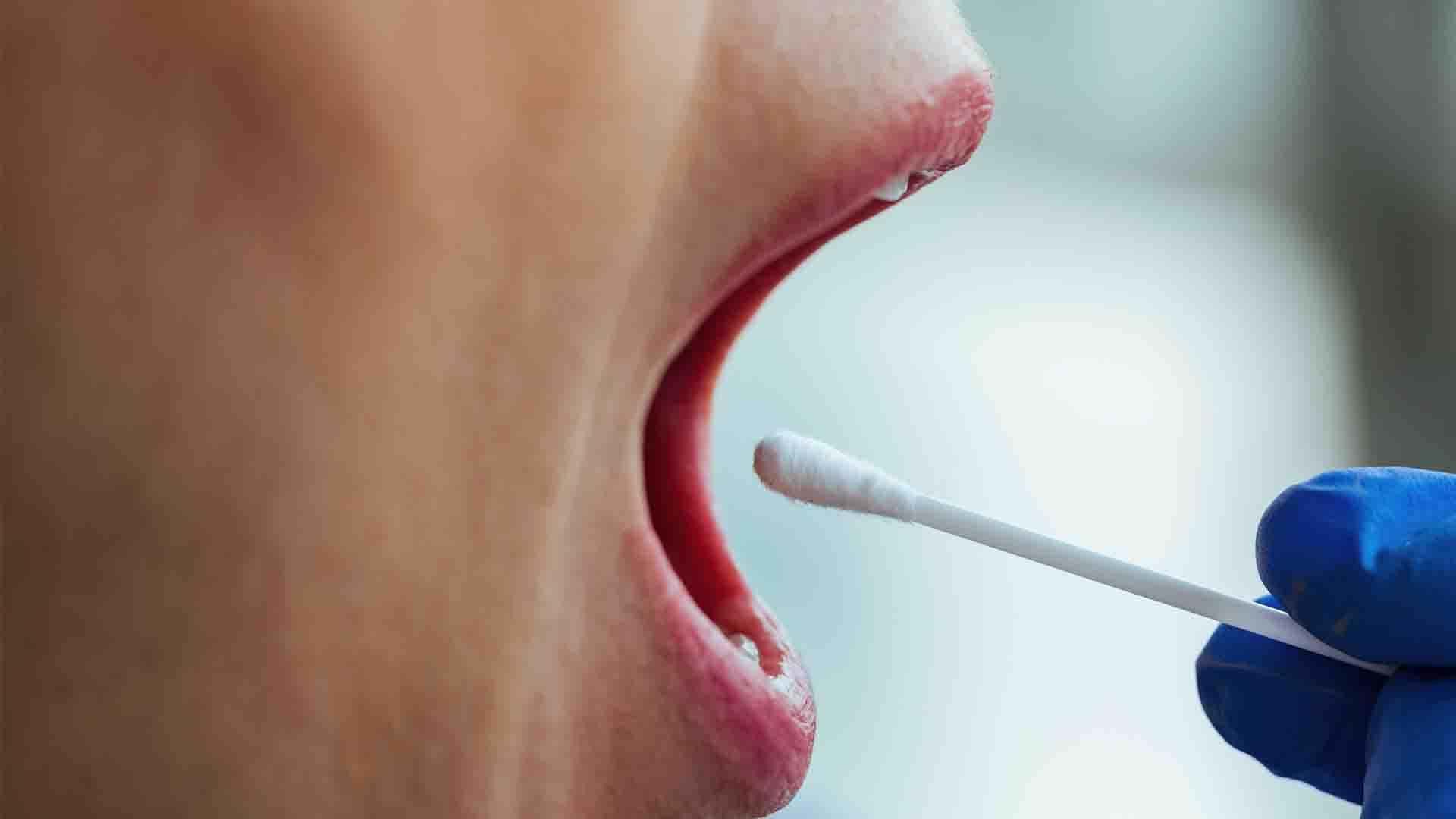 Bientôt un test salivaire pour dépister l'endométriose ?